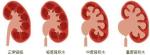 哈尔滨做肾功能检查医院