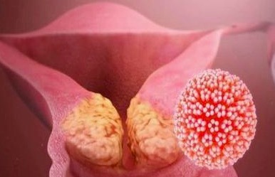 男童喉咙长菜花样肿块确诊感染HPV 因接触到了母亲病毒的分泌物