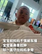 3岁娃满脸伤痕却只惦记车祸受伤妈妈 母子温情触动全网