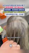 长白头发不是因为老 是你太累了 压力大导致白发增多