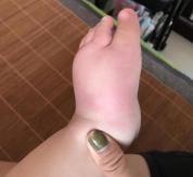 90%的人都不知道蚊子最怕什么 天然植物驱虫魔盒守护家人安宁夜