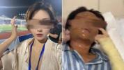 炸伤女子嫌犯说女主播是榜一大哥的 案件一审即将开庭