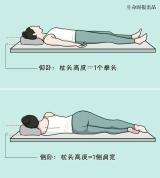 换了一个新枕头 退休老师突发脑梗 颈椎不适埋隐患