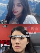 主刀医生称鞋拔子脸比之前更洋气 医疗事故需彻查