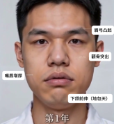 女子陪弟弟看病自己查出肿瘤 意外发现挽救生命