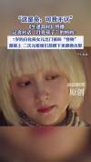 妈妈称7岁白化病女儿出门被喊怪物 温暖与误解并存