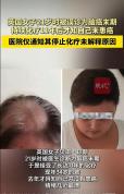 英国34岁女子化疗11年被告知没患癌 误诊改变人生轨迹