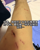 男子爬山被困：绝望时想到钱没花完 生死边缘的自救与获救