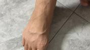 晚上睡觉总抽筋？可能不只是缺钙 肌肉疲劳与电解质失衡也是原因