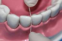 你有用牙线的习惯吗？维护口腔健康的必备技巧