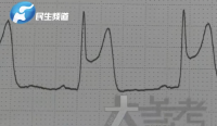 男子常年凌晨3点睡心电图变成墓碑状 熬夜险酿悲剧