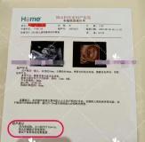 17岁未成年彝族女孩成代孕妈妈 非法代孕背后的悲剧