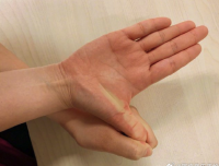 上班族手腕酸痛怎么緩解：一個(gè)動(dòng)作就能自測(cè)鼠標(biāo)手