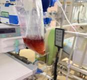 吃了一包堅果,，5歲孩子住進ICU，此病南方高發(fā) 警惕“蠶豆病”