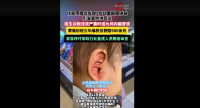 上海住家保姆过失致幼童鼓膜破裂 医生诊断幼童严重时或为颅内脑脊液