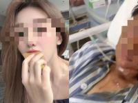 男子自制易燃物泄私憤燒傷女主播 案件明日一審開庭