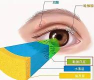 多用洗眼液可以保护眼睛？无依据 眼睛自我清洁已足够