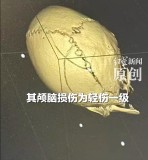 孩子在充氣堡玩耍被推倒 家長斥責(zé)被人打進(jìn)ICU