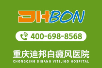 今日要闻：重庆哪家医院白癜风靠谱“效果好”白癜风早期一般会有哪些表现