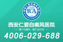 刚刚发布！西安哪里有白癜风医院"top排名"白癜风康复后定期复查需要检查哪些项目