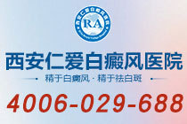 新榜排名！西安哪家白癜风医院效果好"口碑一览"白癜风治疗中出现“同形反应”怎么办