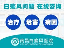 南昌冶白癜风哪里医院会*-白癜风快讯：南昌治疗白癜风的医院在哪“更新推出”