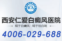 本周榜单！西安看白癜风专业的医院"排行揭晓"眼部白癜风怎么治疗