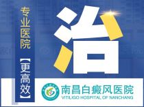 南昌白癜风医院治便宜吗-南昌哪家医院看白癜风强