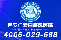 重要新闻！西安有哪些白癜风专科医院"排行榜单"白癜风患者选择衣服要注意什么
