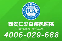 白癜风就医指南:理性看待西安仁爱专科复杂病例处理能力