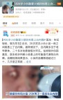 25歲小伙一夜之間患上白內(nèi)障 代謝異常成因探析