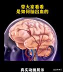 小伙摔倒送医无外伤回家几天后身亡 警惕隐形伤害