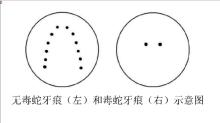 專家談毒蛇咬傷牙痕 海南蛇傷事件頻發(fā)