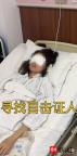 遭男子水槍攻擊失明女孩發(fā)聲 尋找目擊證人