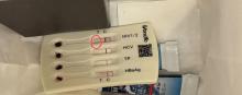 酒店洗漱包现已用HIV检测盒 住客担忧感染风险