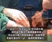 女孩贫血腹泻胃里取出12厘米发团