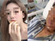 男子自制易燃物泄私愤烧伤女主播 案件明日一审开庭