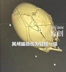 孩子在充氣堡玩耍被推倒 家長斥責(zé)被人打進ICU