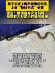 男子上廁所被蛇咬傷淡定拍照自救 冷靜應(yīng)對轉(zhuǎn)危為安