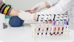 成都中医哮喘医院冉然医生：哮喘必查6项目