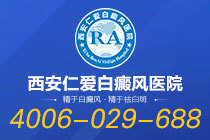 新榜发布！西安看白癜风的医院哪家正规"排名前五"白癜风扩散时患者该怎么做