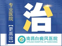 南昌白癜风医院治便宜吗-南昌哪家医院看白癜风强