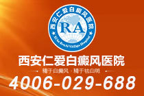 重点关注！西安哪个白癜风医院专业"榜单前五"白癜风稳定了还会再发作吗