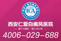 刚刚公开！西安白癜风专业正规医院"排行榜单"治疗白癜风的方法有哪些