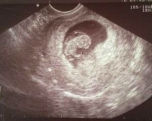四个月的胎儿心跳多少正常呢 四个月的胎儿心率多少