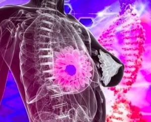 乳腺癌中晚期症状有哪些 乳腺癌治疗预防新模式有哪些