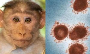重庆发现1例境外输入猴痘病例 专家：疫情传播风险低