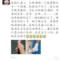 女子夜爬大蜀山被毒蛇咬伤！这种蛇善于伪装