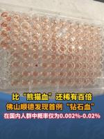 廣東順德發(fā)現(xiàn)一例鉆石血 稀有度超熊貓血百倍