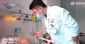 老人13年前脑肿瘤未根除，钙化成石头